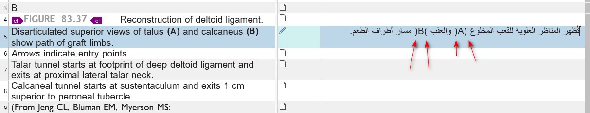 Screenshot of Trados Studio 2022 showing misalignment of BiDi text in Editor. English text on left, Arabic on right with misplaced punctuation and red arrows pointing to errors.