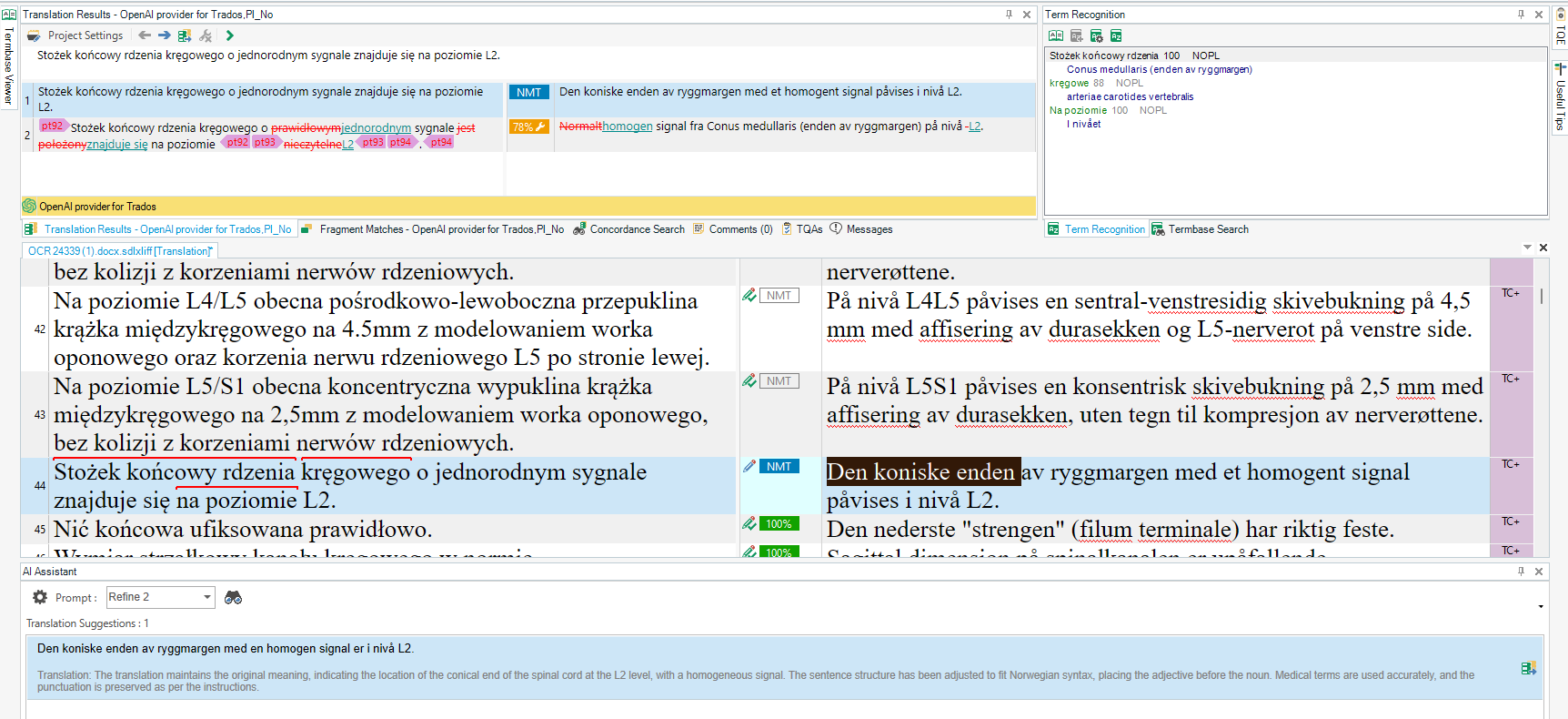 Screenshot of a translation software interface with highlighted text showing a mismatch in term recognition. The term 'conus medullaris' is incorrectly replaced by an unrecognized term, despite having a 100 value in the term base.