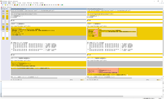 Trados Studio interface showing a comparison between source and target markdown files with highlighted differences. The layout appears disrupted with missing spaces.